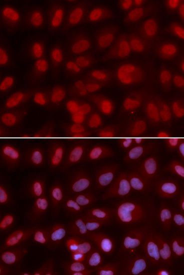 Immunofluorescence - SIN3A Polyclonal Antibody (144-01577)