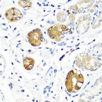 Immunohistochemistry - SGSH antibody (144-08148)