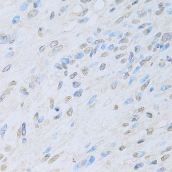 Immunohistochemistry - KAT2A Polyclonal Antibody (144-61334)