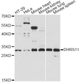 Western blot - DHRS11 antibody (144-60665)
