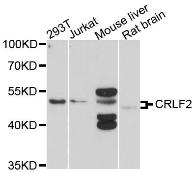 Western blot - CRLF2 Polyclonal Antibody (144-010152)