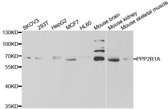 Western blot - PPP2R1A Polyclonal Antibody (144-05799)