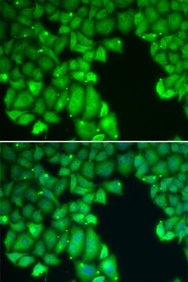 Immunofluorescence - CASP10 Polyclonal Antibody (144-60015)