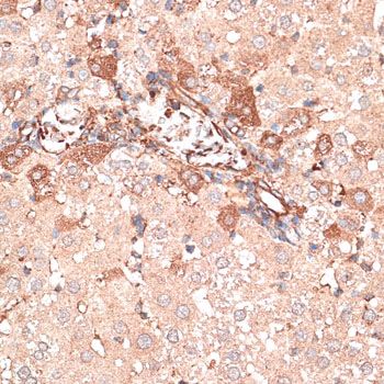 Immunohistochemistry - KTN1 antibody (144-012456)
