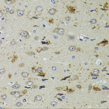 Immunohistochemistry - PTPN3 antibody (144-06400)