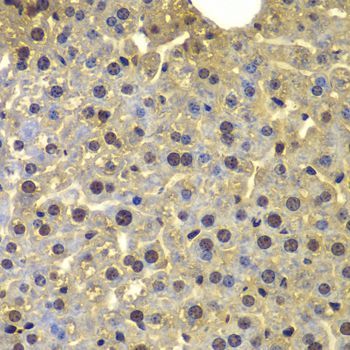 Immunohistochemistry - SORT1 Polyclonal Antibody (144-07926)