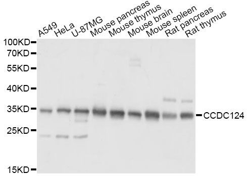 Western blot - CCDC124 Polyclonal Antibody (144-60668)