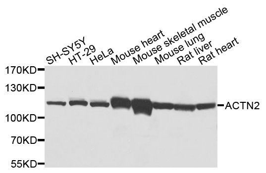 Western blot - ACTN2 Polyclonal Antibody (144-03718)