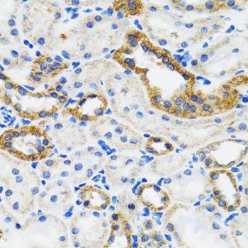 Immunohistochemistry - CHUK Polyclonal Antibody (144-02062)