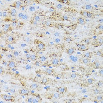 Immunohistochemistry - TIRAP antibody (144-12606)