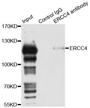 Immunoprecipitation - 3ug ERCC4 antibody (144-08119)
