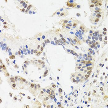 Immunohistochemistry - [KO Validated] SUZ12 Polyclonal Antibody (144-07786)