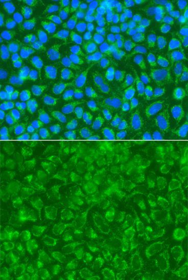 Immunofluorescence - STRN antibody (144-07734)