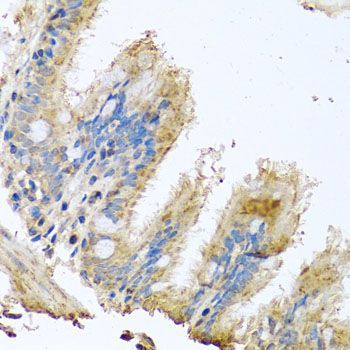 Immunohistochemistry - COX6B1 antibody (144-02641)