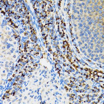Immunohistochemistry - SRP19 Polyclonal Antibody (144-06752)