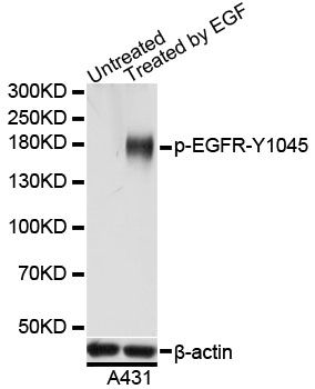 Western blot - Phospho-EGFR-Y1045 pAb (144-61535)