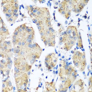 Immunohistochemistry - PLEK antibody (144-06305)