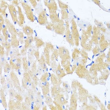 Immunohistochemistry - EIF2S1 Polyclonal Antibody (144-00764)
