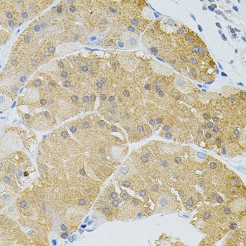 Immunohistochemistry - SYK Antibody (144-02123)