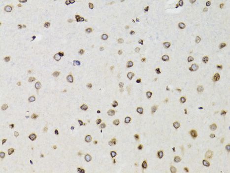 Western blot - [KO Validated] TMPO Polyclonal Antibody (144-02534)