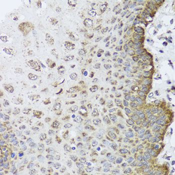 Immunohistochemistry - FANCL Polyclonal Antibody (144-06812)