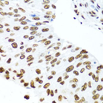 Immunohistochemistry - SSB Polyclonal Antibody (144-00630)
