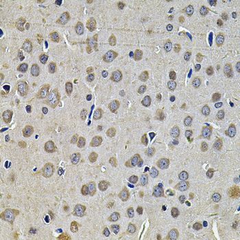 Immunohistochemistry - DNAJA3 Polyclonal Antibody (144-07030)
