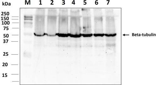 Western blot image