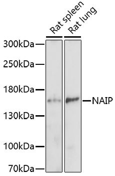 Western blot