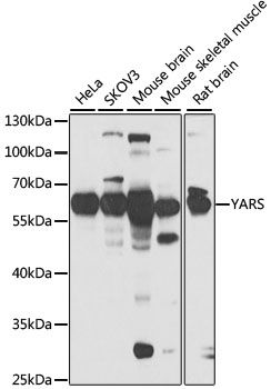 Western blot - YARS Polyclonal Antibody (144-06791)