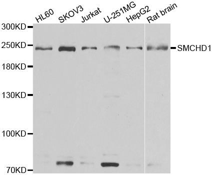 Western blot - SMCHD1 antibody (144-07214)