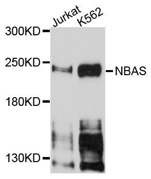 Western blot - NBAS antibody (144-04748)