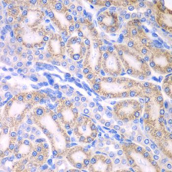 Immunohistochemistry - ALDH1A2 antibody (144-07503)