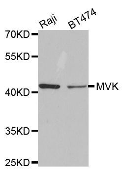 Western blot - MVK antibody (144-05354)