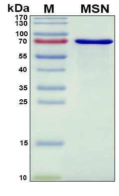 SDS-PAGE