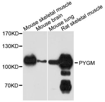 Western blot - PYGM antibody (144-09392)