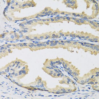 Immunohistochemistry - CST3 antibody (144-60265)