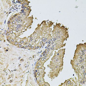 Immunohistochemistry - PTCD3 Polyclonal Antibody (144-08497)