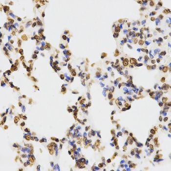 Immunohistochemistry - DiMethyl-Histone H3-K9 antibody (144-02359)