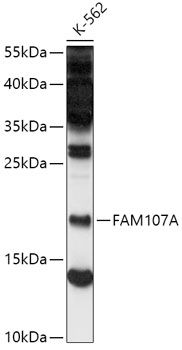 Western blot