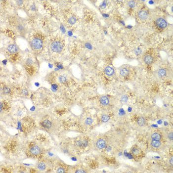 Immunohistochemistry - CALD1 antibody (144-05366)