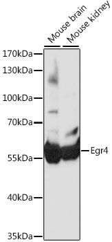 Western blot