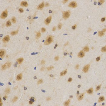Immunohistochemistry - ELAVL1 Polyclonal Antibody (144-01608)