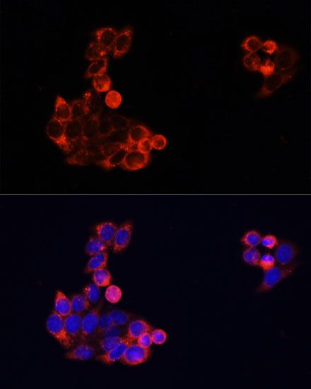 Immunofluorescence - EGFR Polyclonal Antibody (144-011577)