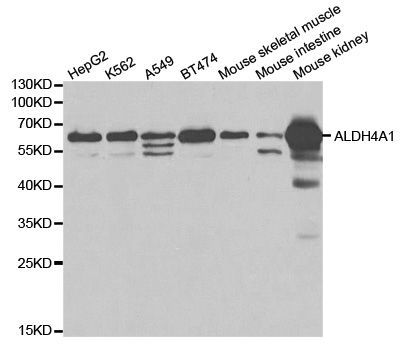 Western blot - ALDH4A1 antibody (144-02595)