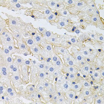 Immunohistochemistry - IGF1R Polyclonal Antibody (144-00243)
