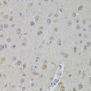 Immunohistochemistry - NME1 Polyclonal Antibody (144-00259)