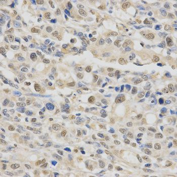 Immunohistochemistry - SPHK1 Polyclonal Antibody (144-00139)