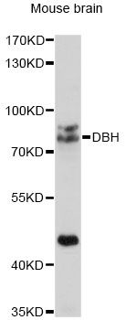 Western blot - DBH antibody (144-02711)