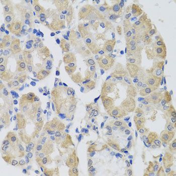 Immunohistochemistry - GPT antibody (144-02814)